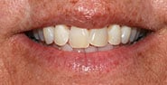 Before Image: Case 471 - front