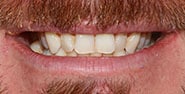 Before Image: Case 473 - front