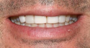 Before Image: Case 476 - front