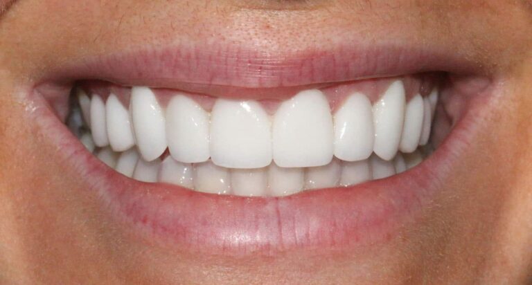 After Image: Case 478 - front