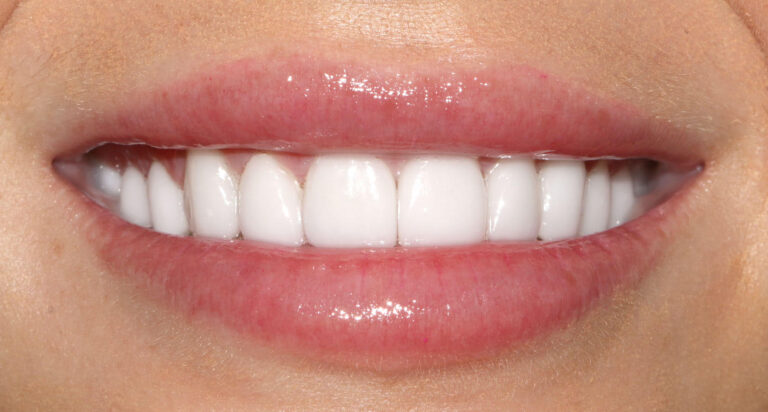 After Image: Case 486 - front