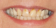 Before Image: Case 66 - front