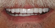 After Image: Case 7 - front