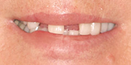 Before Image: Case 71 - front