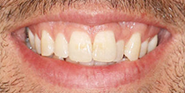 Before Image: Case 75 - front