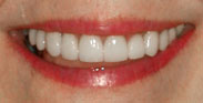 After Image: Case 9 - front