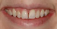 Before Image: Case 99 - front