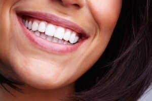 A close-up shot of a woman’s smile after teeth whitening