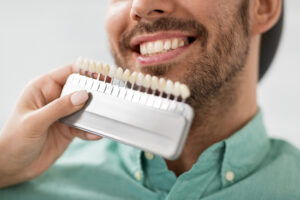 Man having his teeth color-matched for porcelain veneers even though he has issues with bruxism