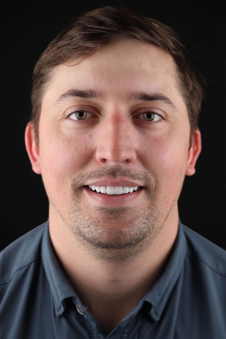 After Image: Case 489 - front