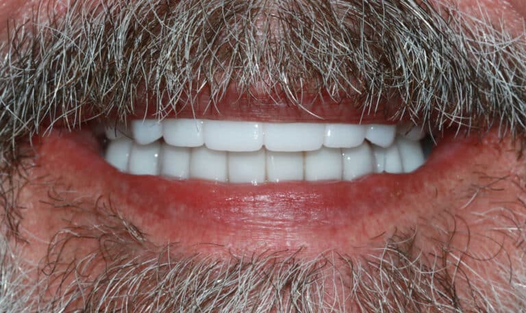 After Image: Case 490 - front