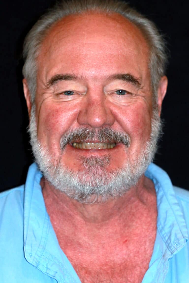 Before Image: Case 490 - front