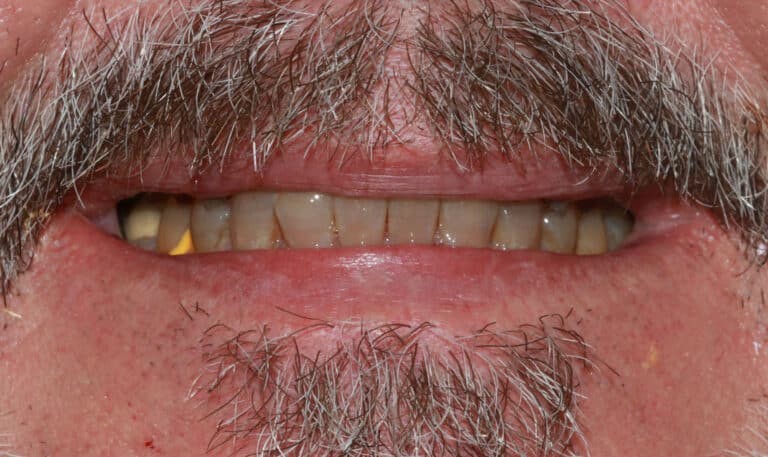 Before Image: Case 490 - front