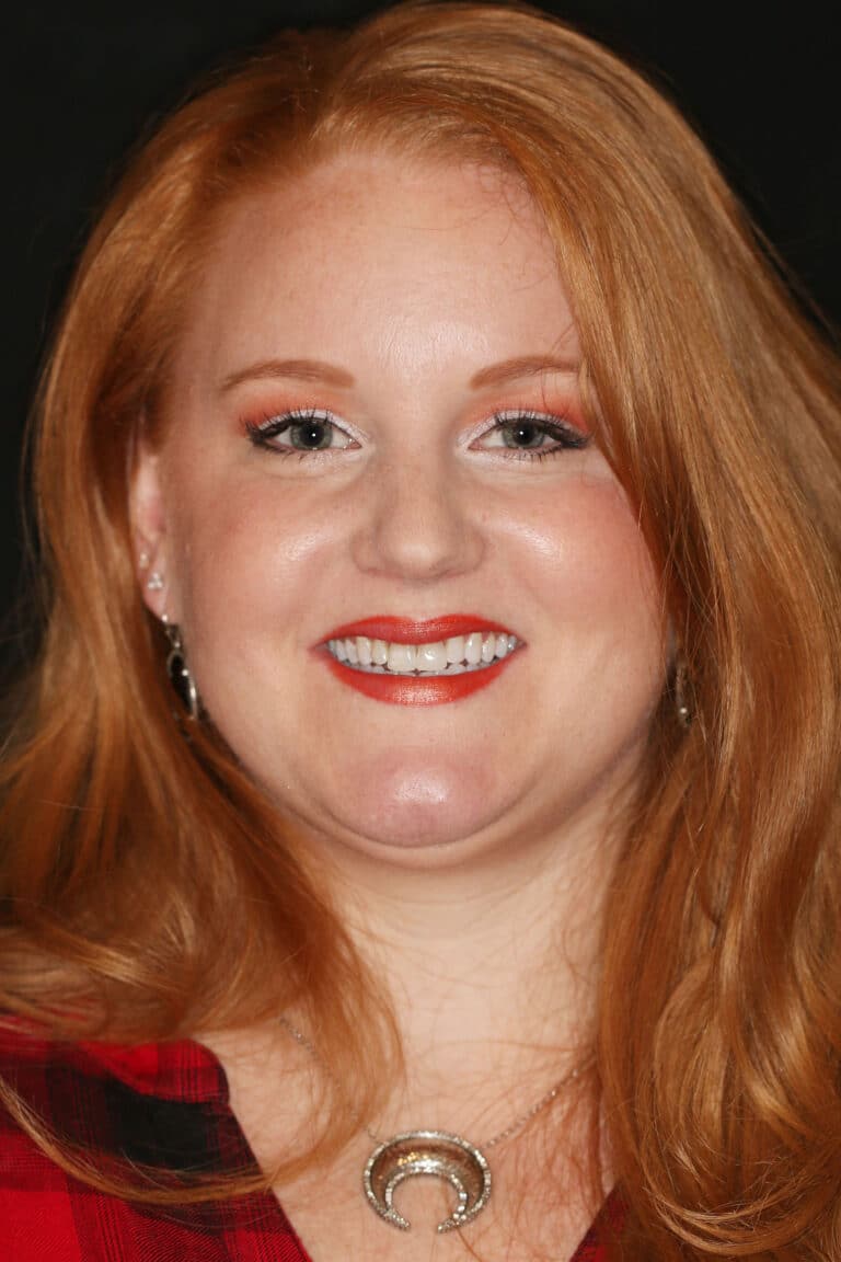 Before Image: Case 491 - front