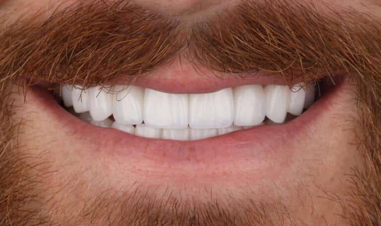 After Image: Case 503 -