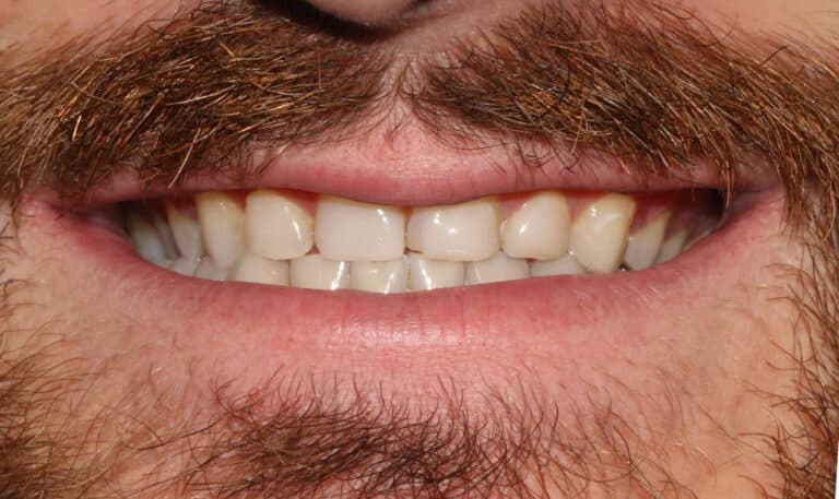 Before Image: Case 503 -