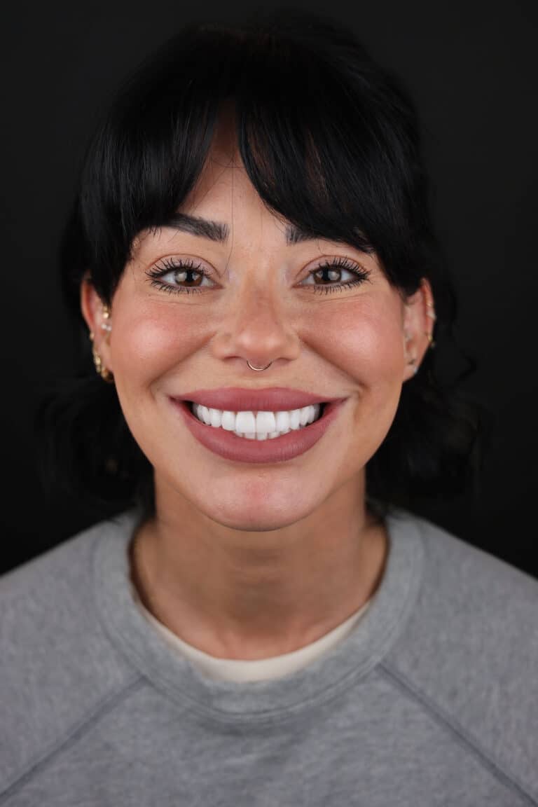 After Image: Case 504 - front