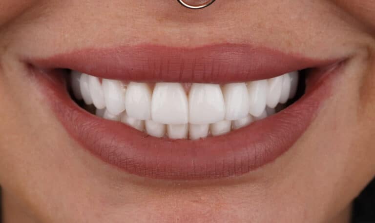 After Image: Case 504 -