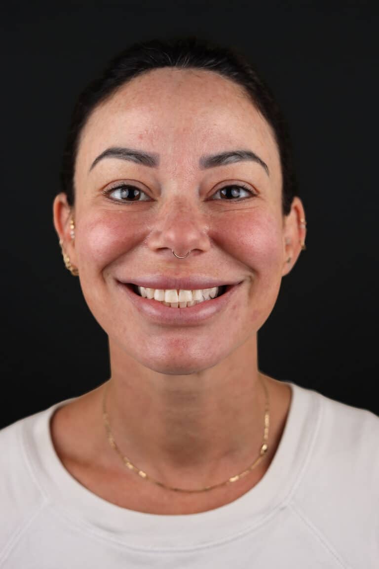 Before Image: Case 504 - front