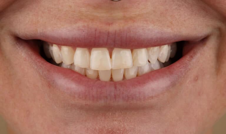 Before Image: Case 504 -