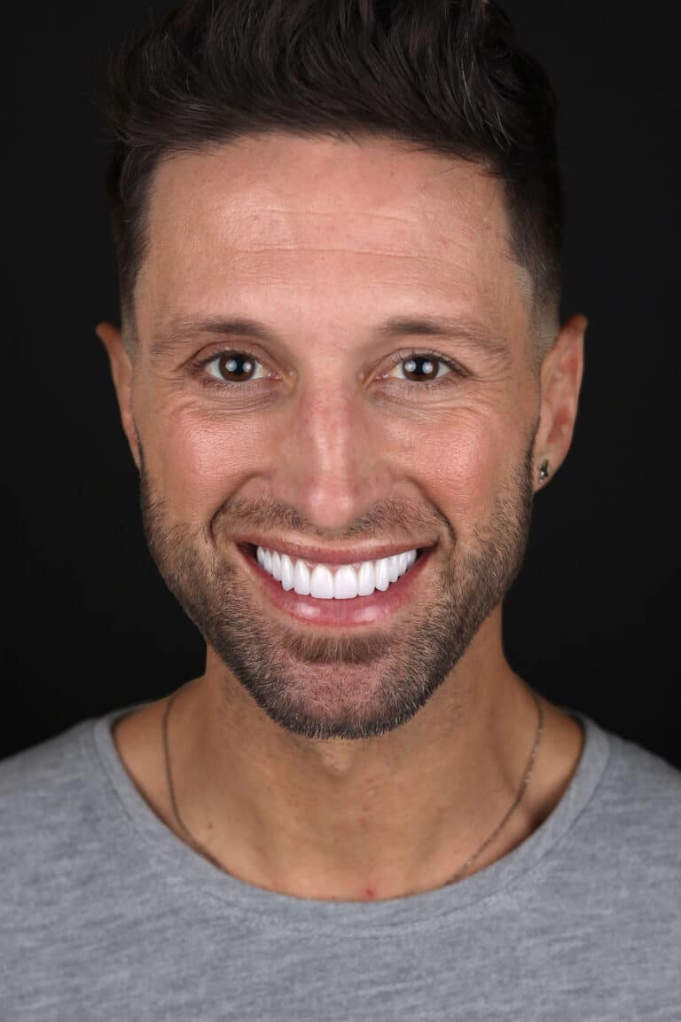 After Image: Case 505 - front