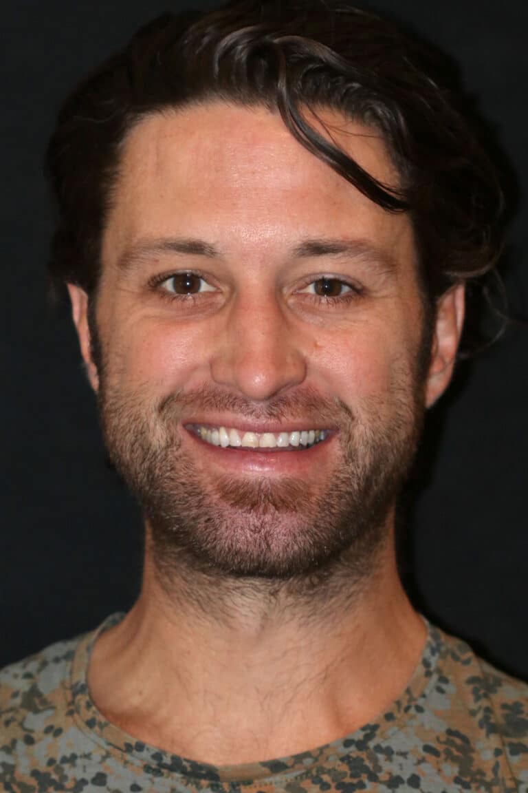 Before Image: Case 505 - front