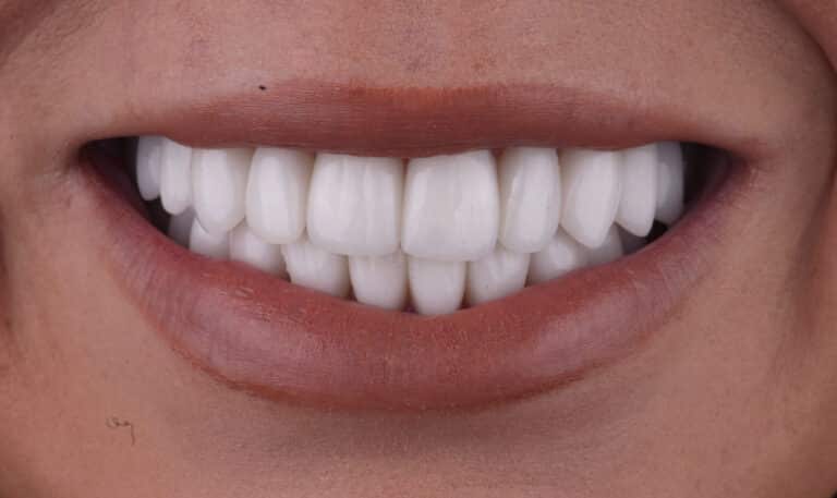 After Image: Case 506 -