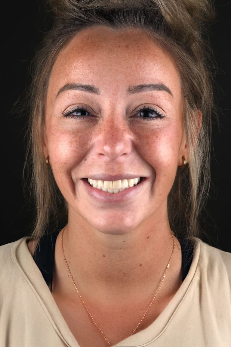 Before Image: Case 506 - front