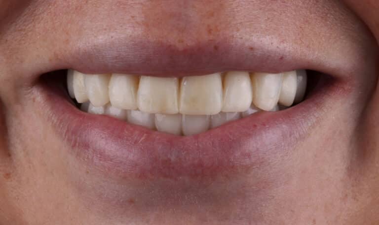 Before Image: Case 506 -