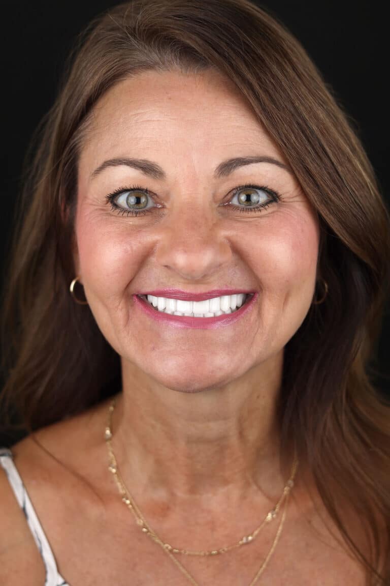 After Image: Case 493 - front