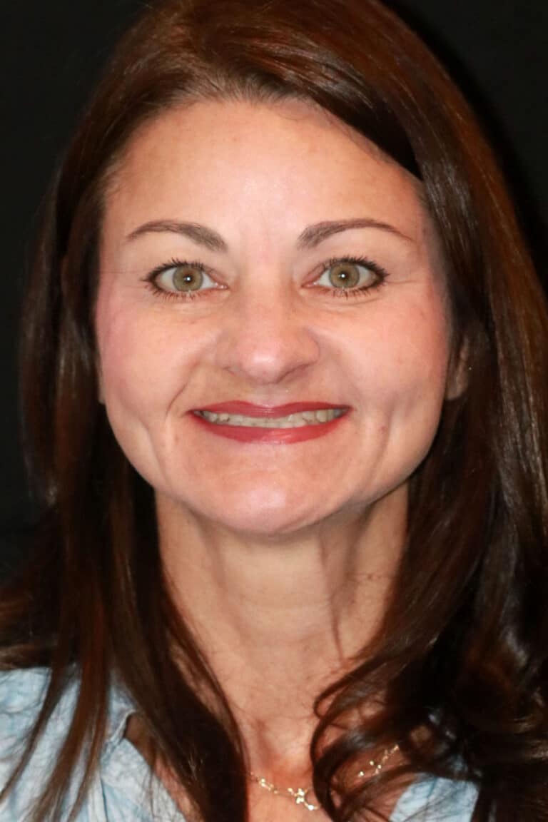 Before Image: Case 493 - front