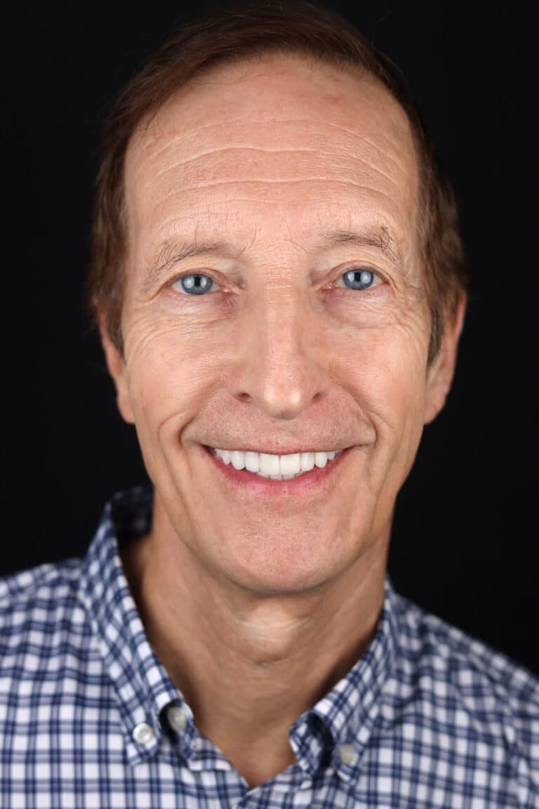 After Image: Case 494 - front