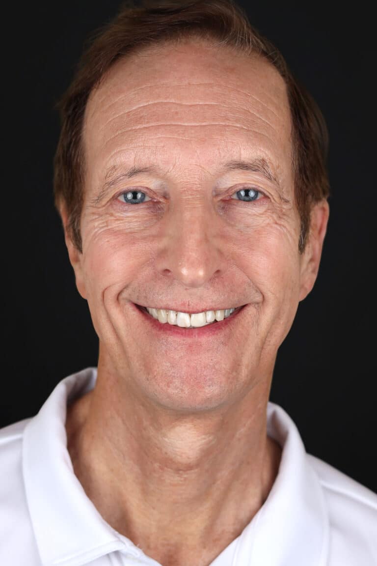 Before Image: Case 494 - front