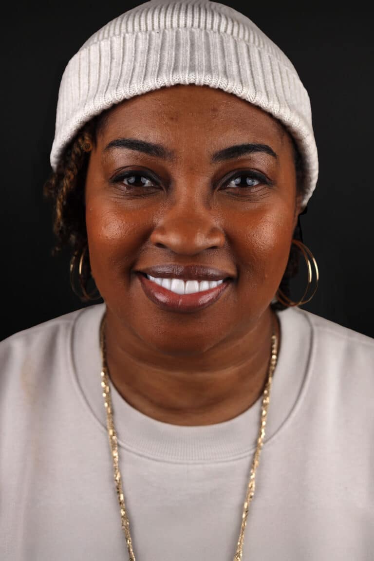 After Image: Case 496 - front