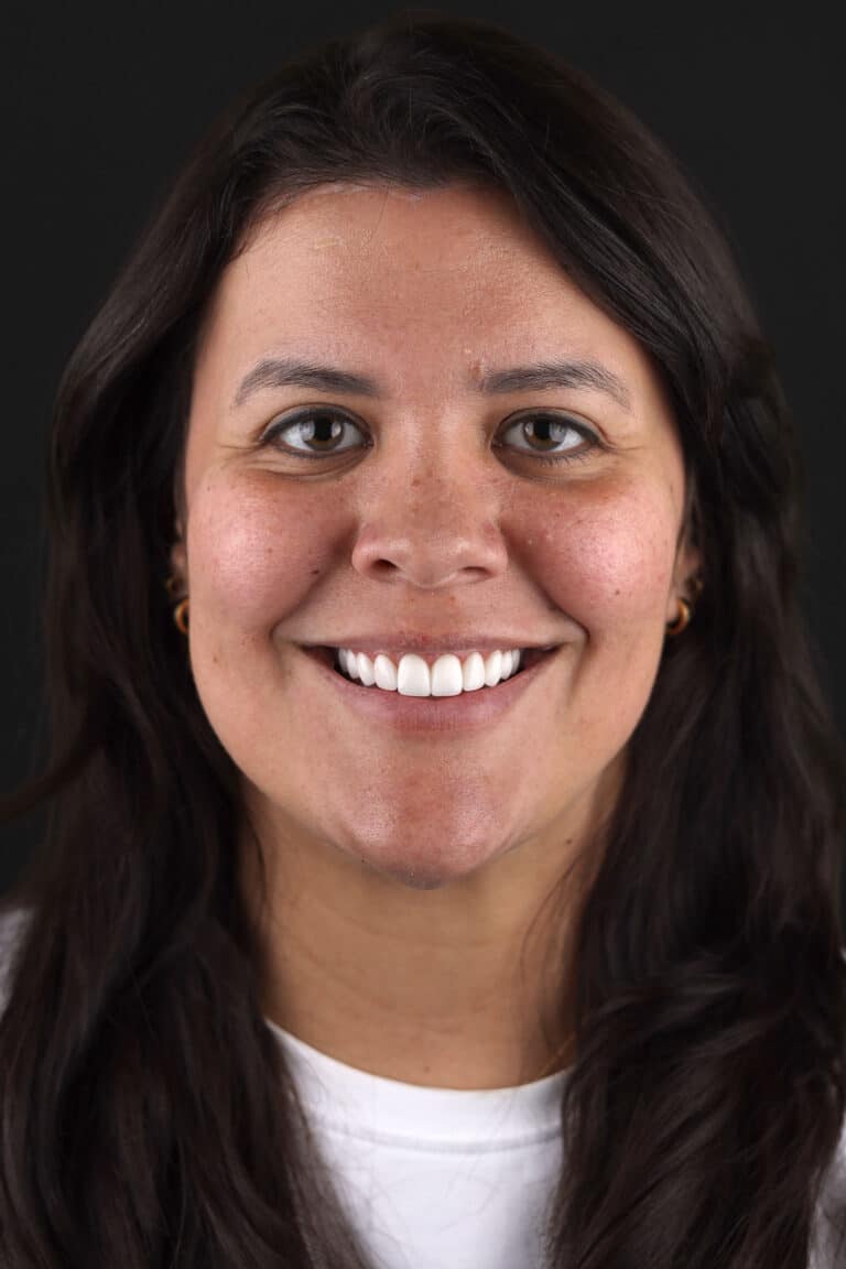 After Image: Case 500 - front