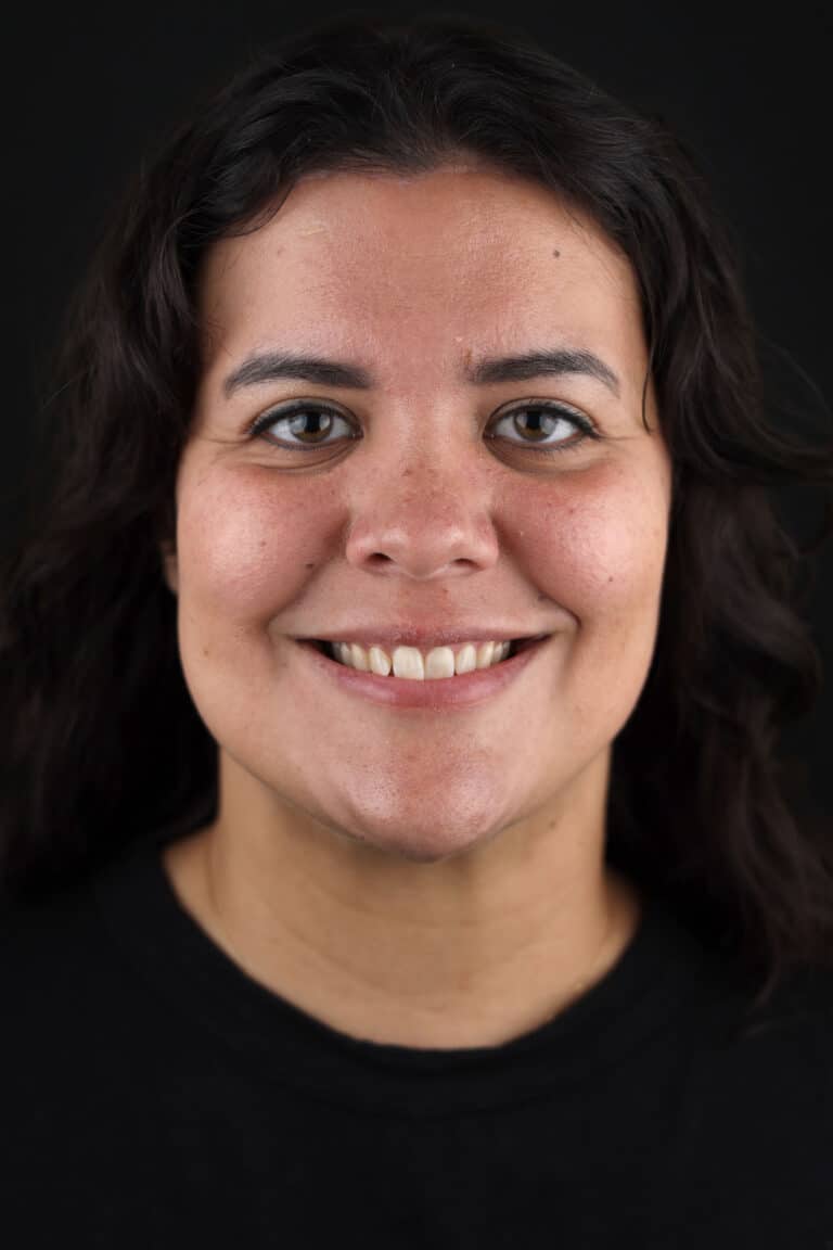 Before Image: Case 500 - front