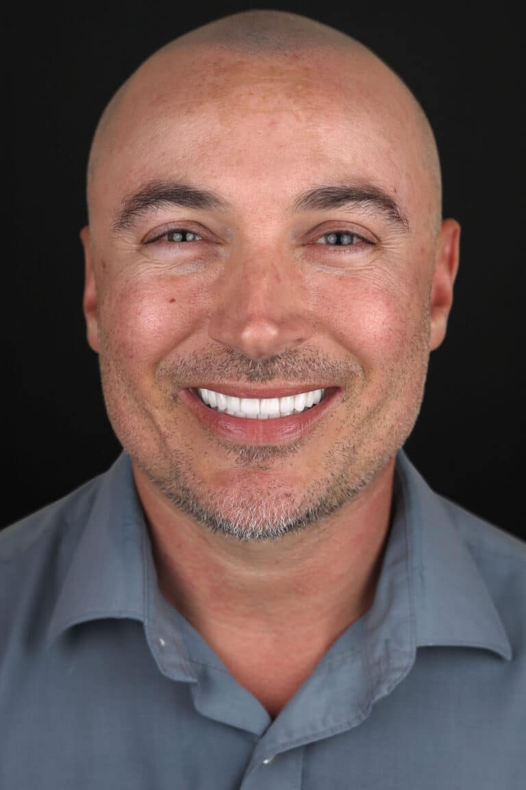 After Image: Case 499 - front