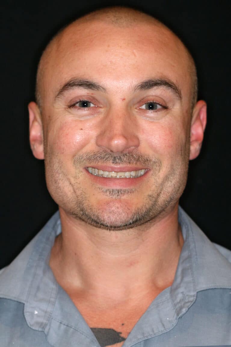 Before Image: Case 499 - front