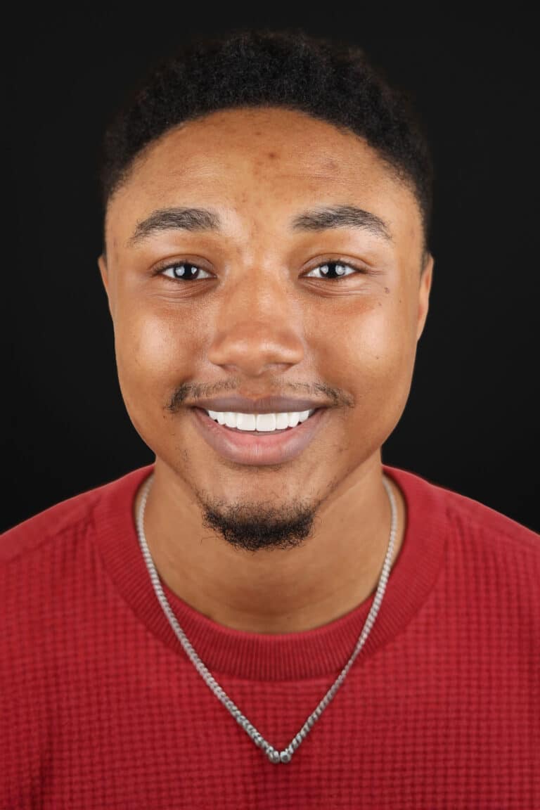 After Image: Case 501 - front