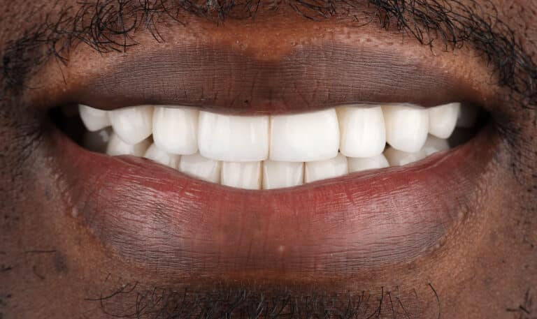 After Image: Case 502 -