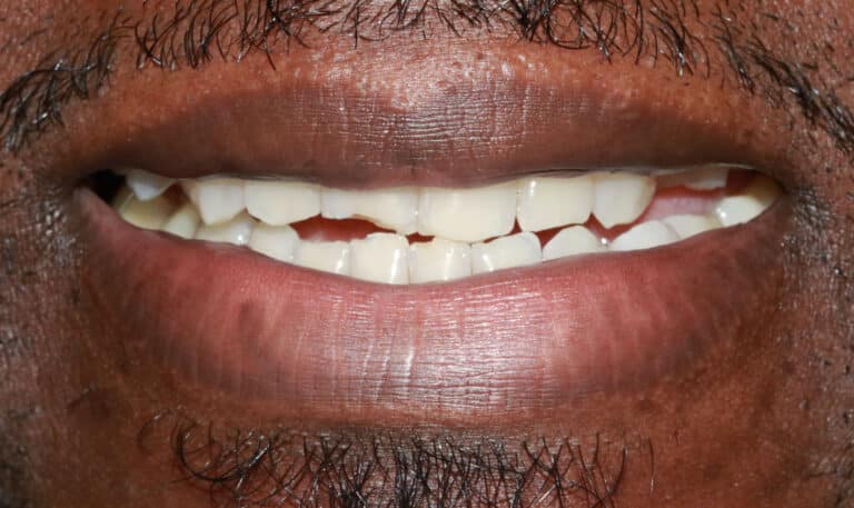 Before Image: Case 502 -