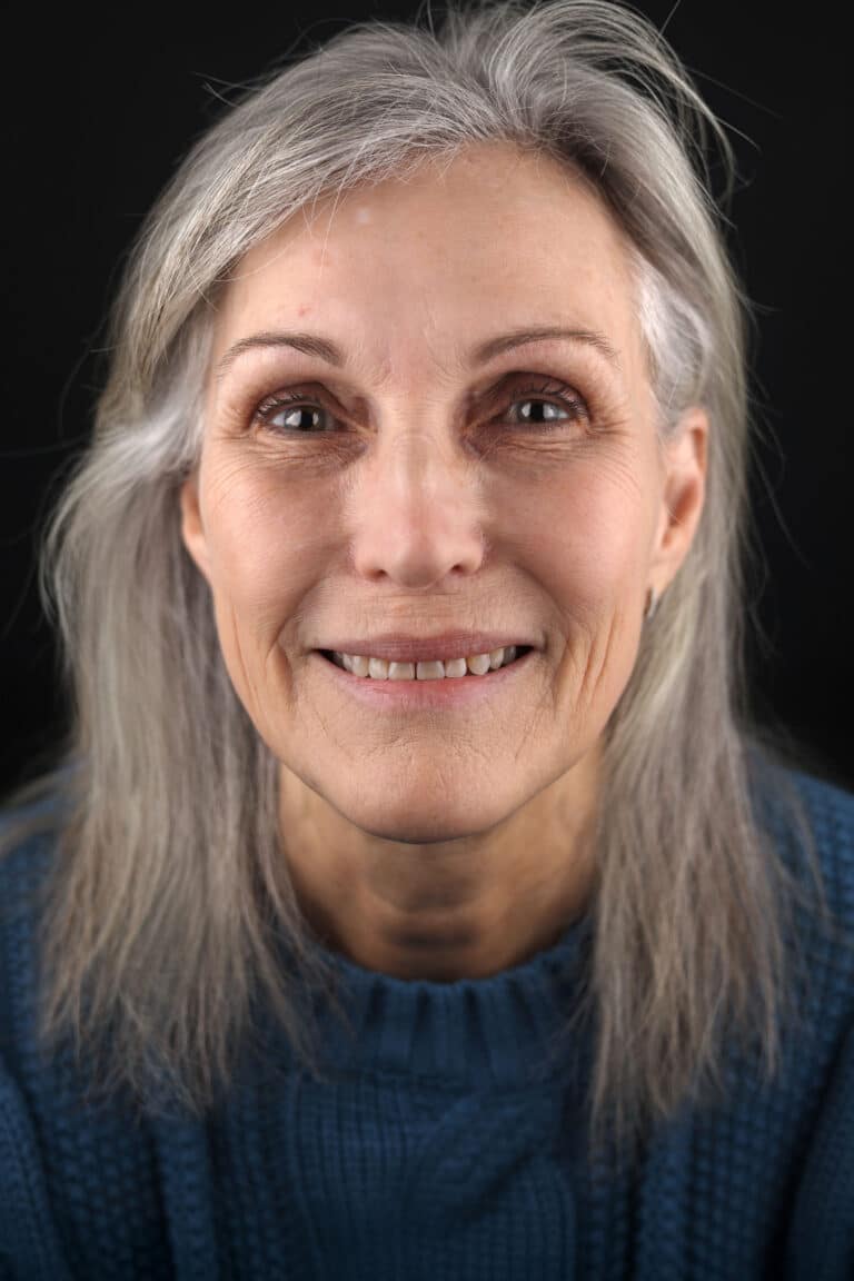 Before Image: Case 492 - front